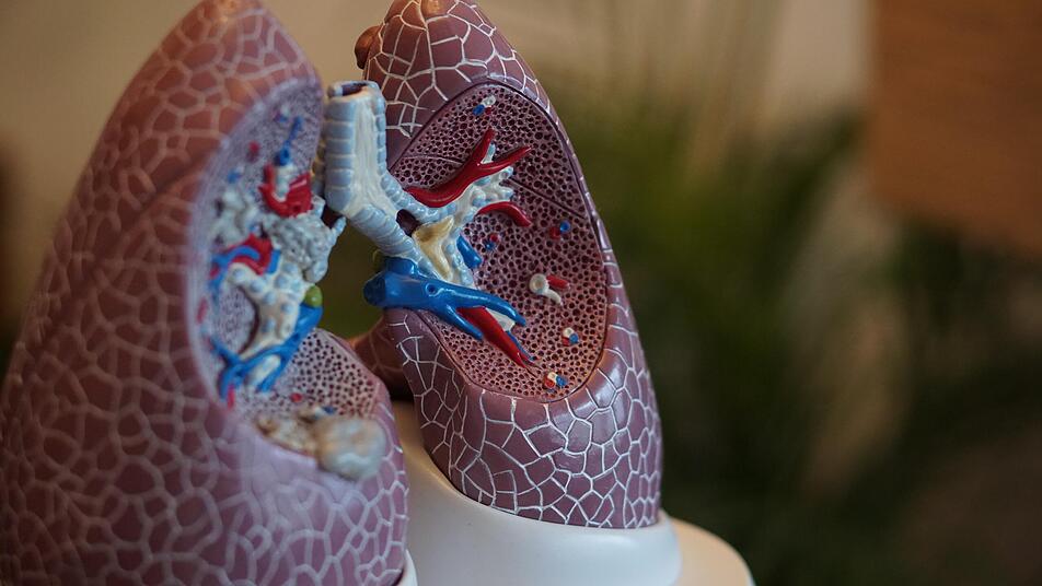 Lungenkrankheit Copd Forscher Glauben An Vollstandig Heilung Durch Immunzellen